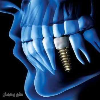 دکتر شهرام سلیمی