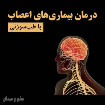 دکتر فرهاد صبری  طب سوزنی