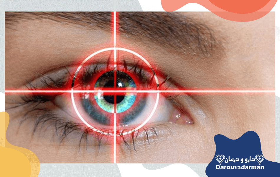 کاربرد لیزر در جراحی چشم