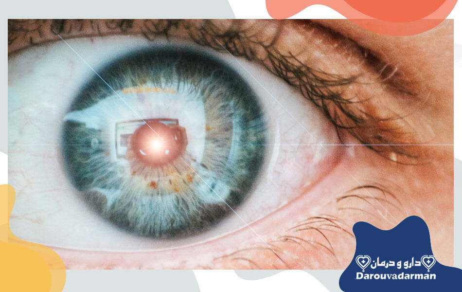 عمل لازک چشم چیست؟